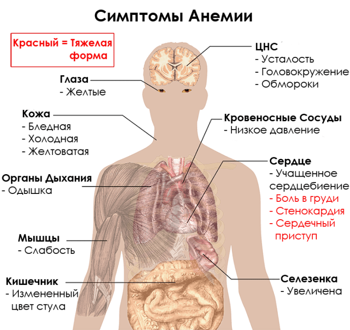 proyavleniya-anemii